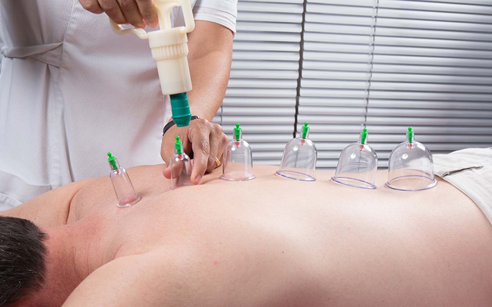 Untitled-2_0003_b67-what-is-cupping-therapy-1525809372